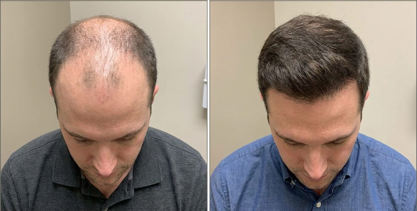 Before & After
